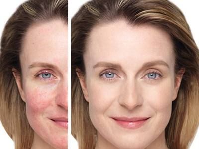 妆后修护|肌肤补水和抗氧化，如何